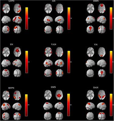 Networks Are Associated With Acupuncture Treatment in Patients With Diarrhea-Predominant Irritable Bowel Syndrome: A Resting-State Imaging Study